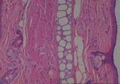 Hematoxylin & Eosin Stain: Rat organs formalin fixed Tissue MicroArray (Normal) [NBP2-30226] - 01. Skin, Ear lobe