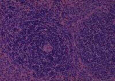 Hematoxylin & Eosin Stain: Rat organs formalin fixed Tissue MicroArray (Normal) [NBP2-30226] - 02. spleen