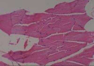 Hematoxylin & Eosin Stain: Rat organs formalin fixed Tissue MicroArray (Normal) [NBP2-30226] - 03. Skeletal Muscle abdominal wall