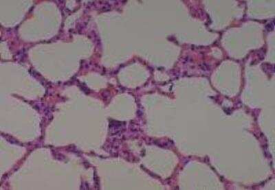 Hematoxylin & Eosin Stain: Rat organs formalin fixed Tissue MicroArray (Normal) [NBP2-30226] - 04. Lung