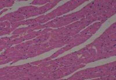 Hematoxylin & Eosin Stain: Rat organs formalin fixed Tissue MicroArray (Normal) [NBP2-30226] - 05. Heart