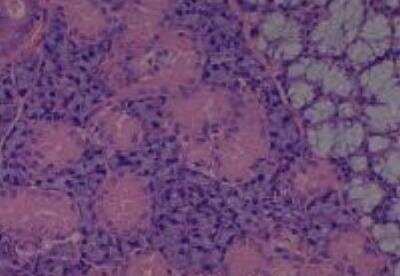 Hematoxylin & Eosin Stain: Rat organs formalin fixed Tissue MicroArray (Normal) [NBP2-30226] - 06. Salivary gland