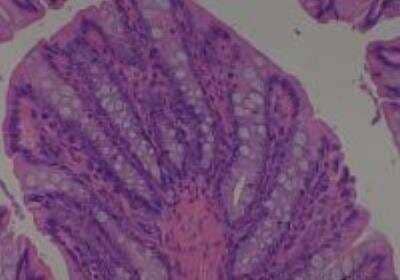 Hematoxylin & Eosin Stain: Rat organs formalin fixed Tissue MicroArray (Normal) [NBP2-30226] - 11. Colon