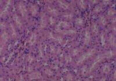 Hematoxylin & Eosin Stain: Rat organs formalin fixed Tissue MicroArray (Normal) [NBP2-30226] - 13. Kidney, Medulla