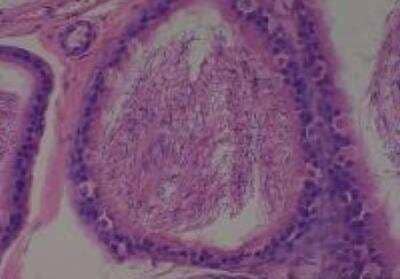 Hematoxylin & Eosin Stain: Rat organs formalin fixed Tissue MicroArray (Normal) [NBP2-30226] - 17. Epididymis