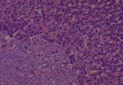 Hematoxylin & Eosin Stain: Rat organs formalin fixed Tissue MicroArray (Normal) [NBP2-30226] - 19. Adrenal gland