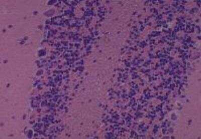 Hematoxylin & Eosin Stain: Rat organs formalin fixed Tissue MicroArray (Normal) [NBP2-30226] - 23. Cerebellum