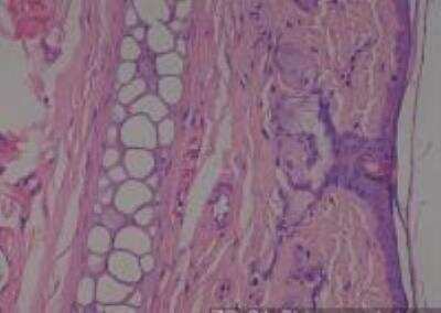 Hematoxylin & Eosin Stain: Rat organs formalin fixed Tissue MicroArray (Normal) [NBP2-30227] - 01. Skin, Ear Lobe