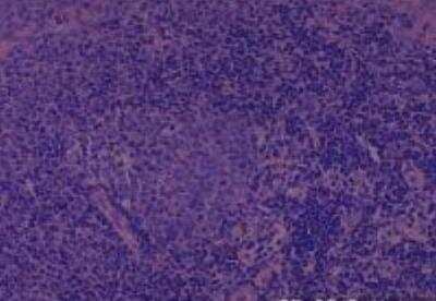 Hematoxylin & Eosin Stain: Rat organs formalin fixed Tissue MicroArray (Normal) [NBP2-30227] - 02. Spleen