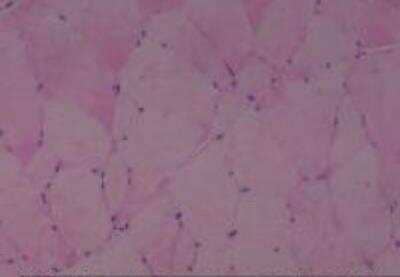 Hematoxylin & Eosin Stain: Rat organs formalin fixed Tissue MicroArray (Normal) [NBP2-30227] - 03. Skeletal muscle abdominal wall