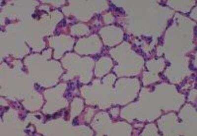 Hematoxylin & Eosin Stain: Rat organs formalin fixed Tissue MicroArray (Normal) [NBP2-30227] - 04. Lung