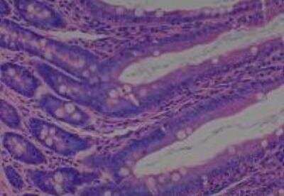 Hematoxylin & Eosin Stain: Rat organs formalin fixed Tissue MicroArray (Normal) [NBP2-30227] - 10. Lieum