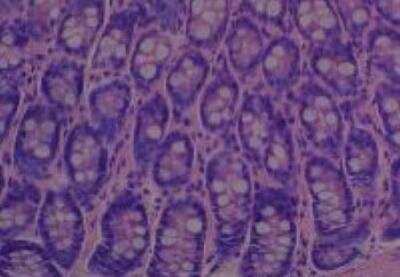 Hematoxylin & Eosin Stain: Rat organs formalin fixed Tissue MicroArray (Normal) [NBP2-30227] - 11. Colon