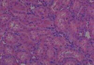 Hematoxylin & Eosin Stain: Rat organs formalin fixed Tissue MicroArray (Normal) [NBP2-30227] - 13. Kidney, medulla