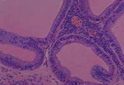 Hematoxylin & Eosin Stain: Rat organs formalin fixed Tissue MicroArray (Normal) [NBP2-30227] - 14. Prostate