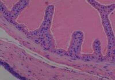 Hematoxylin & Eosin Stain: Rat organs formalin fixed Tissue MicroArray (Normal) [NBP2-30227] - 15. Seminal vesicle