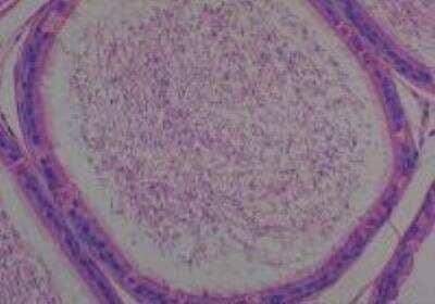 Hematoxylin & Eosin Stain: Rat organs formalin fixed Tissue MicroArray (Normal) [NBP2-30227] - 17. Epididymis