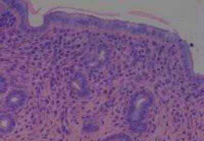 Hematoxylin & Eosin Stain: Rat organs formalin fixed Tissue MicroArray (Normal) [NBP2-30227] - 18. Uterus