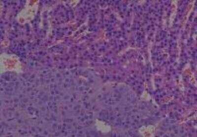 Hematoxylin & Eosin Stain: Rat organs formalin fixed Tissue MicroArray (Normal) [NBP2-30227] - 19. Adrenal