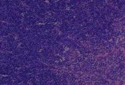 Hematoxylin & Eosin Stain: Rat organs formalin fixed Tissue MicroArray (Normal) [NBP2-30227] - 20. Thymus