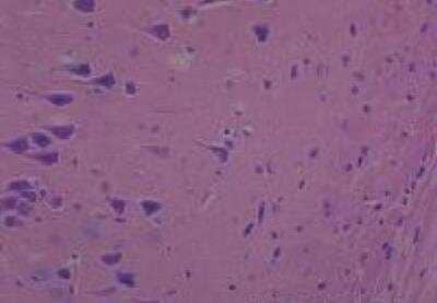 Hematoxylin & Eosin Stain: Rat organs formalin fixed Tissue MicroArray (Normal) [NBP2-30227] - 21. Cerebrum