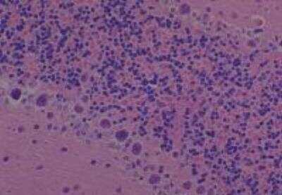 Hematoxylin & Eosin Stain: Rat organs formalin fixed Tissue MicroArray (Normal) [NBP2-30227] - 23. Cerebellum