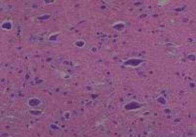 Hematoxylin & Eosin Stain: Rat organs formalin fixed Tissue MicroArray (Normal) [NBP2-30227] - 22. Pons