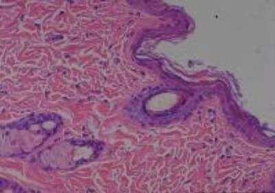 Hematoxylin & Eosin Stain: Rat organs perfusion fixation Tissue MicroArray (Normal) [NBP2-30228] -  02. skin