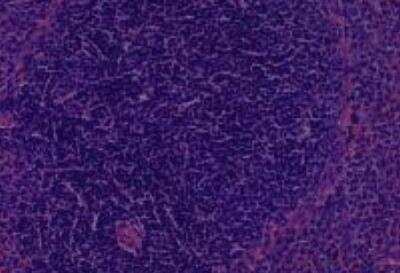 Hematoxylin & Eosin Stain: Rat organs perfusion fixation Tissue MicroArray (Normal) [NBP2-30228] -  03. Spleen