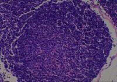 Hematoxylin & Eosin Stain: Rat organs perfusion fixation Tissue MicroArray (Normal) [NBP2-30228] - 05. Lymph Node