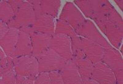 Hematoxylin & Eosin Stain: Rat organs perfusion fixation Tissue MicroArray (Normal) [NBP2-30228] -  06. Skeletal muscle, abdominal wall