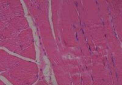 Hematoxylin & Eosin Stain: Rat organs perfusion fixation Tissue MicroArray (Normal) [NBP2-30228] -  07. Skeletal muscle, abdominal wall