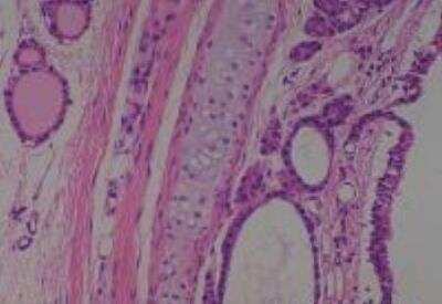 Hematoxylin & Eosin Stain: Rat organs perfusion fixation Tissue MicroArray (Normal) [NBP2-30228] - 08. Trachea