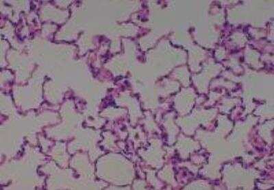 Hematoxylin & Eosin Stain: Rat organs perfusion fixation Tissue MicroArray (Normal) [NBP2-30228] -  09. Lung