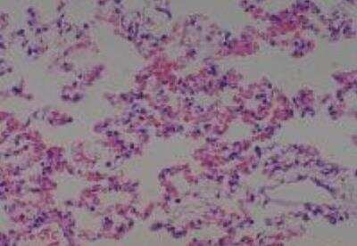 Hematoxylin & Eosin Stain: Rat organs perfusion fixation Tissue MicroArray (Normal) [NBP2-30228] - 10. Lung