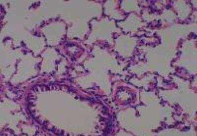 Hematoxylin & Eosin Stain: Rat organs perfusion fixation Tissue MicroArray (Normal) [NBP2-30228] - 11. Lung