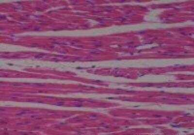 Hematoxylin & Eosin Stain: Rat organs perfusion fixation Tissue MicroArray (Normal) [NBP2-30228] - 12. Heart