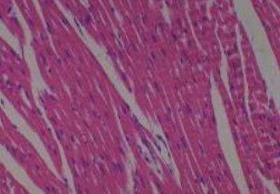 Hematoxylin & Eosin Stain: Rat organs perfusion fixation Tissue MicroArray (Normal) [NBP2-30228] -  13. Heart