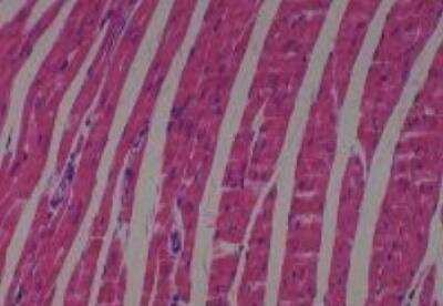 Hematoxylin & Eosin Stain: Rat organs perfusion fixation Tissue MicroArray (Normal) [NBP2-30228] - 14. Heart