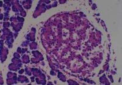 Hematoxylin & Eosin Stain: Rat organs perfusion fixation Tissue MicroArray (Normal) [NBP2-30228] - 22. Pancreas