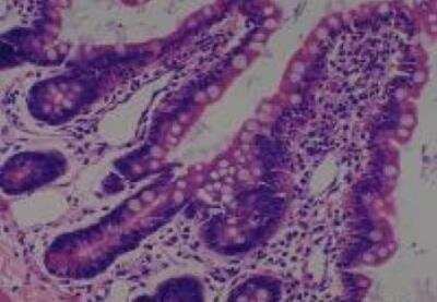 Hematoxylin & Eosin Stain: Rat organs perfusion fixation Tissue MicroArray (Normal) [NBP2-30228] -  26. Small Intestine