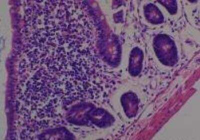 Hematoxylin & Eosin Stain: Rat organs perfusion fixation Tissue MicroArray (Normal) [NBP2-30228] - 27. Small intestine