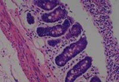 Hematoxylin & Eosin Stain: Rat organs perfusion fixation Tissue MicroArray (Normal) [NBP2-30228] -  28. Small Intestine