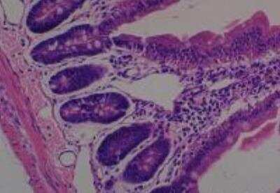 Hematoxylin & Eosin Stain: Rat organs perfusion fixation Tissue MicroArray (Normal) [NBP2-30228] - 29. Small intestine