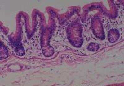 Hematoxylin & Eosin Stain: Rat organs perfusion fixation Tissue MicroArray (Normal) [NBP2-30228] -  30. Cecum