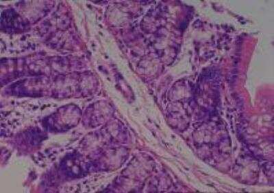 Hematoxylin & Eosin Stain: Rat organs perfusion fixation Tissue MicroArray (Normal) [NBP2-30228] -  31. Cecum