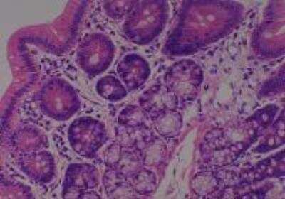 Hematoxylin & Eosin Stain: Rat organs perfusion fixation Tissue MicroArray (Normal) [NBP2-30228] - 32. Colon