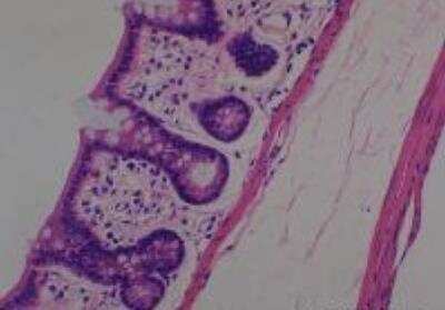 Hematoxylin & Eosin Stain: Rat organs perfusion fixation Tissue MicroArray (Normal) [NBP2-30228] - 33. Colon