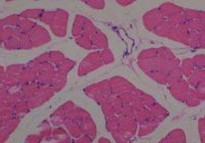 Hematoxylin & Eosin Stain: Rat organs perfusion fixation Tissue MicroArray (Normal) [NBP2-30228] -  35. Diaphragm