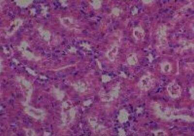 Hematoxylin & Eosin Stain: Rat organs perfusion fixation Tissue MicroArray (Normal) [NBP2-30228] - 39. Kidney, Medulla